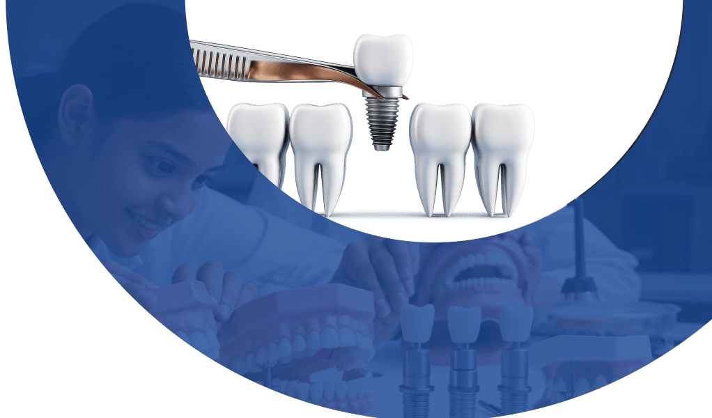 Dental Implants in Manikonda